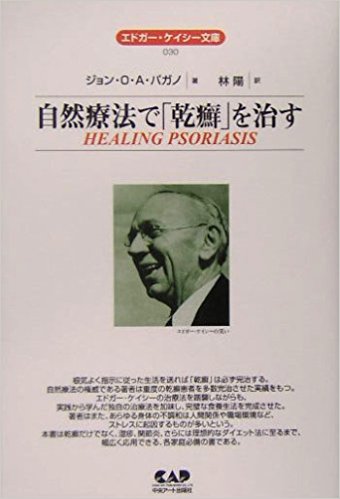 自然療法で「乾癬」を治す (エドガー・ケイシー文庫)