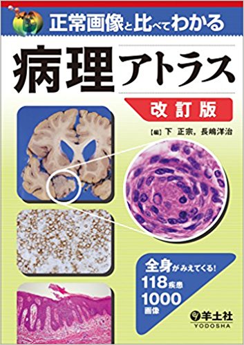 正常画像と比べてわかる 病理アトラス　改訂版